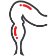 Anal Cancer