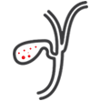 Bile duct Cancer