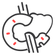 Pancreatic Cancer