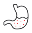 Stomach Cancer